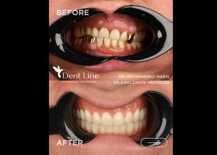 Запит на перепротезування. Лікарі Овчаренко Маріс та Холзаков Всеволод