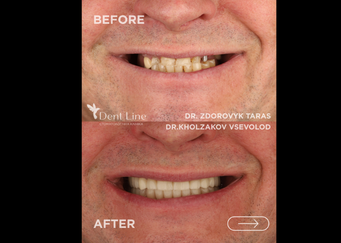 Кейс комплексної реабілітації пацієнта. Лікарі Здоровик Тарас та Холзаков Всеволод